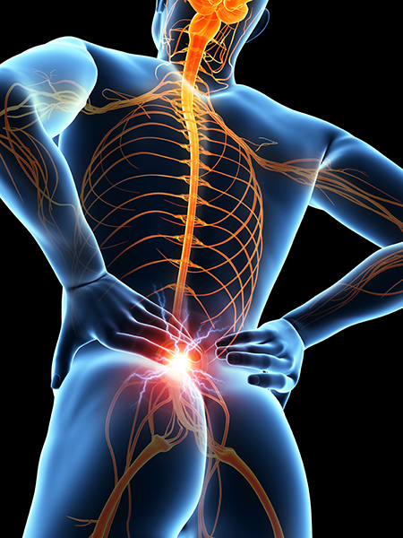 Sacroiliac Joint Injection - Ainsworth Institute