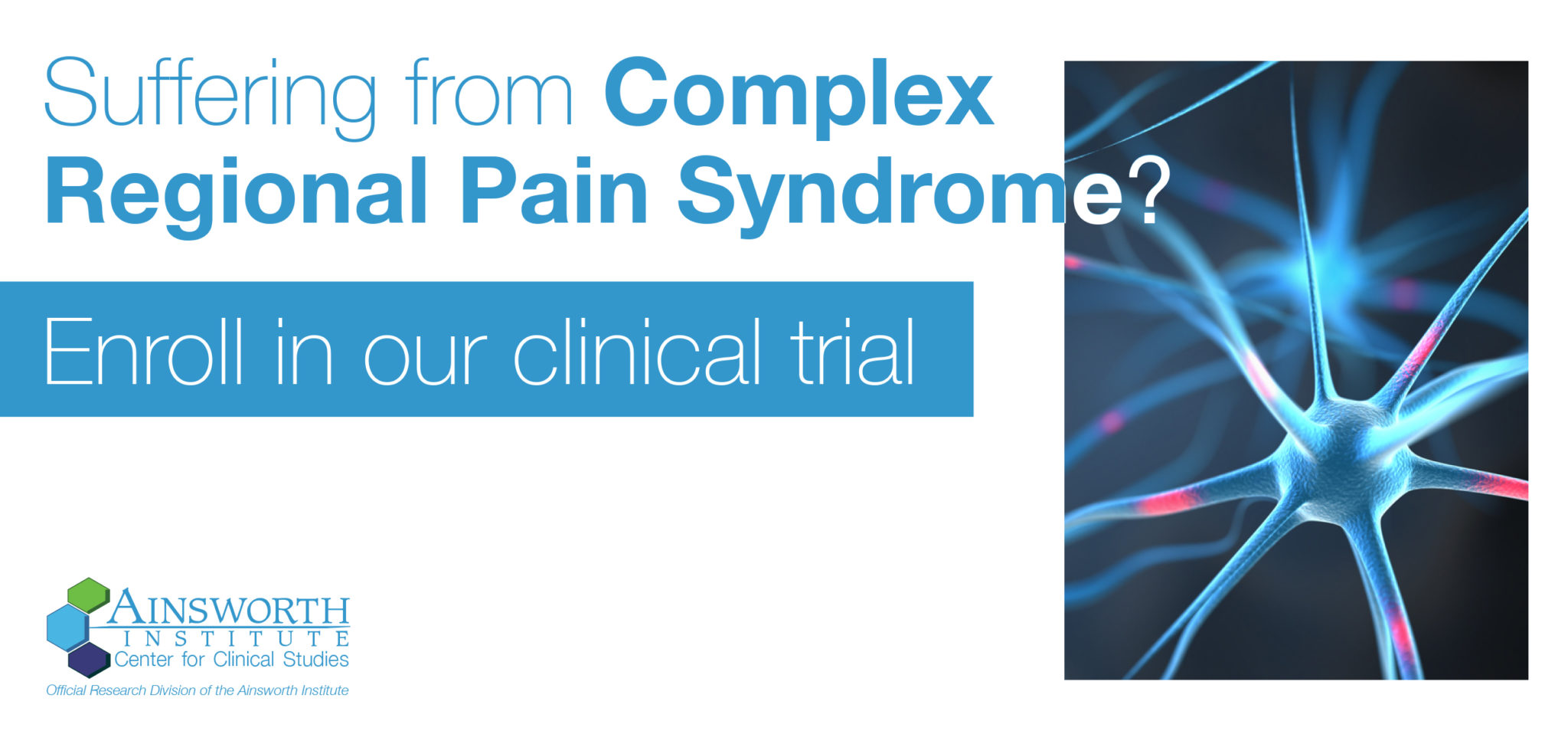 CRPS Complex Regional Pain Syndrome Clinical Trial