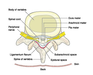 neck pain, disc herniation, disc bulge, arm pain, neck pain treatment NYC