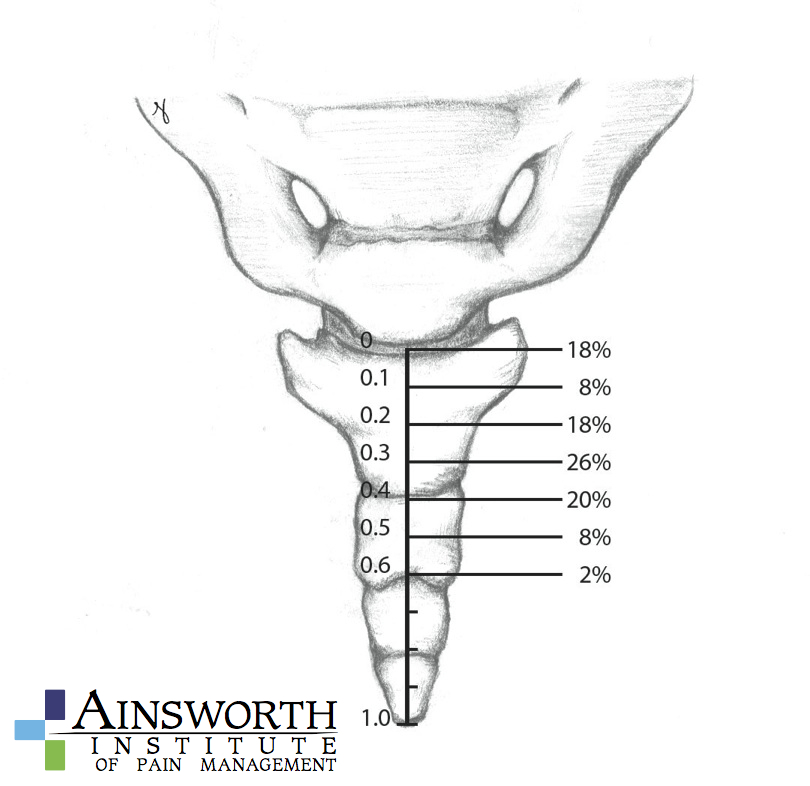 Ganglion of Impar Block Ainsworth Institute