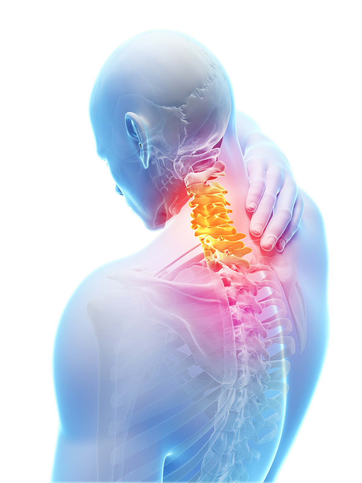 Cervical Radiculopathy Condition And Treatment Information