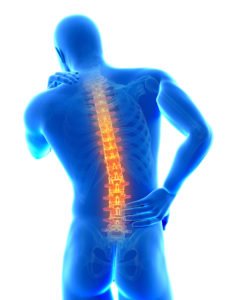Low back pain Saluda EVOKE Saluda, EVOKE, Evoke, closed loop spinal cord stimulation, closed loop SCS