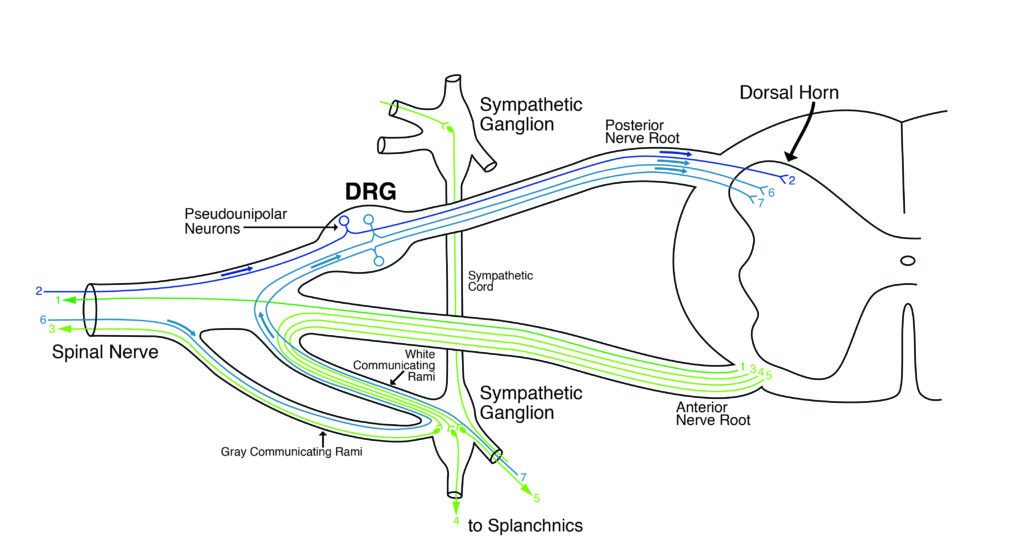 Dorsal Root Ganglion Stimulation, DRG Stim, DRG Stimulation, CRPS, RSD, Causalgia