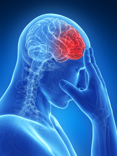 Headache Migraine Facial Pain Atypical Facial Pain