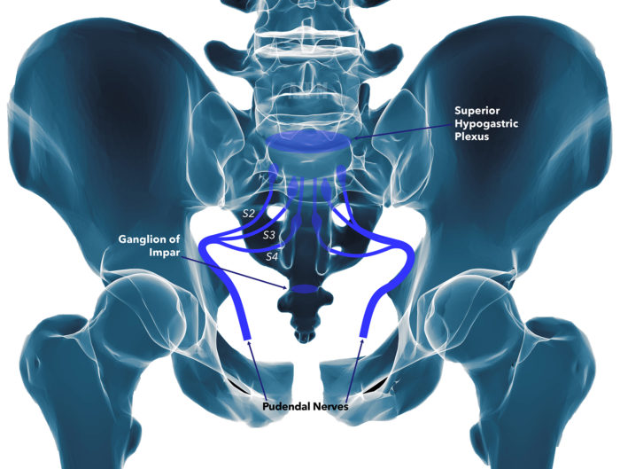 Pain where you sit - Pudendal Neuralgia - Pelvic Pain Foundation